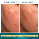 Sérum Haute Puissance Acide Mandélique + Tranexamique 5% Botik 30ml